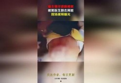 缅北医生爆料视频大全,真实视频大全背后的惊人真相