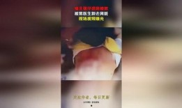 缅北医生爆料视频大全,真实视频大全背后的惊人真相