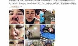 网友爆料被打脸视频播放